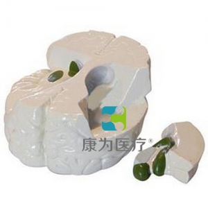 “康為醫(yī)療”海馬、穹隆、前連合模型