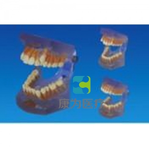 “康為醫(yī)療”正畸錯(cuò)牙合畸形分類(lèi)演示模型