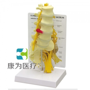 “康為醫(yī)療”醫(yī)患關(guān)系溝通模型-骶骨附腰神經(jīng)、右側(cè)骶骨神經(jīng)和坐骨神經(jīng)模型 （醫(yī)學(xué)指導(dǎo)模型）