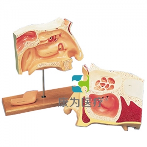 鼻竇內(nèi)窺鏡使用訓(xùn)練模型，2部分-德文注釋