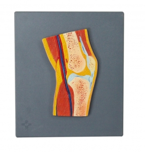 膝關(guān)節(jié)剖面模型