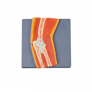 肘關(guān)節(jié)剖面模型