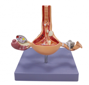 子宮卵巢病變模型